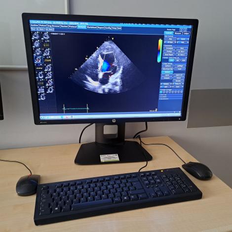 Lepszy komfort badań w Pracowni Echokardiografii Śląskiego Centrum Chorób Serca - Zdjęcie galerii 9
